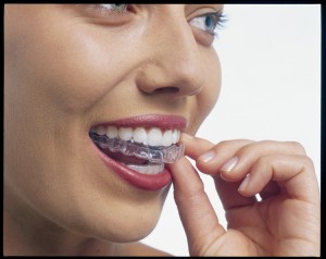 Invisalign
